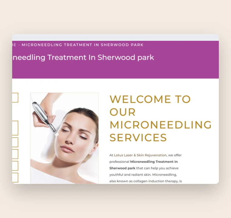 Microneedling treatment page with the treatment menu and description
